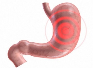  Bệnh viêm loét dạ dày và cách điều trị hiệu quả